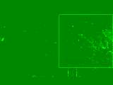 Motion before despeckle